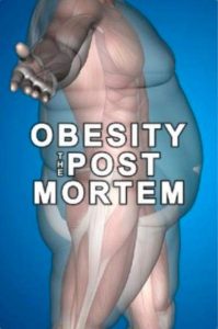 Obesity.The.Post.Mortem.2016.1080p.NF.WEB-DL.DD+2.0.H.264-SiGMA – 2.0 GB