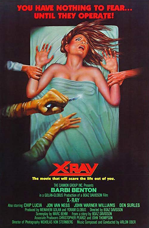 X-Ray.1981.1080p.BluRay.REMUX.AVC.DTS-HD.MA.2.0-EPSiLON – 18.0 GB