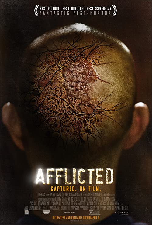 Afflicted.2014.1080p.BluRay.REMUX.AVC.DTS-HD.MA.5.1-TRiToN – 16.2 GB