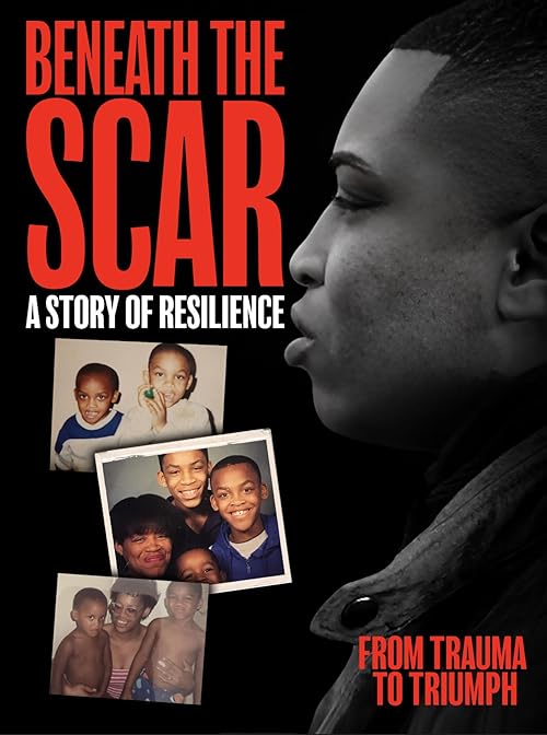 Beneath the Scar: A Story of Resilience