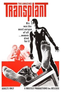 The.Amazing.Transplant.1970.1080p.BluRay.REMUX.AVC.DTS-HD.MA.1.0-BLURANiUM – 17.9 GB