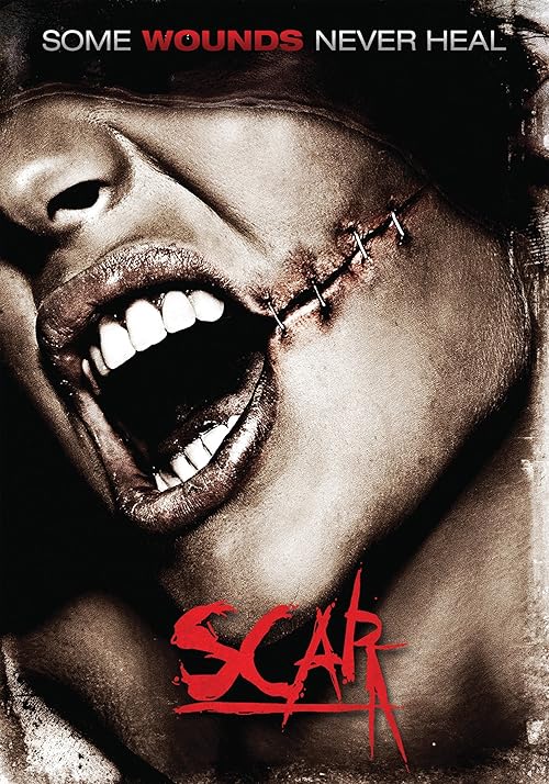 Scar