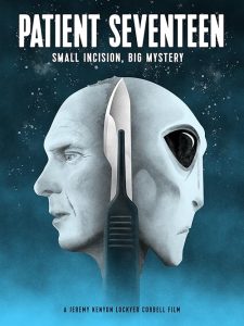 Patient.Seventeen.2017.1080P.WEB.H264-GRASHOPR – 2.3 GB